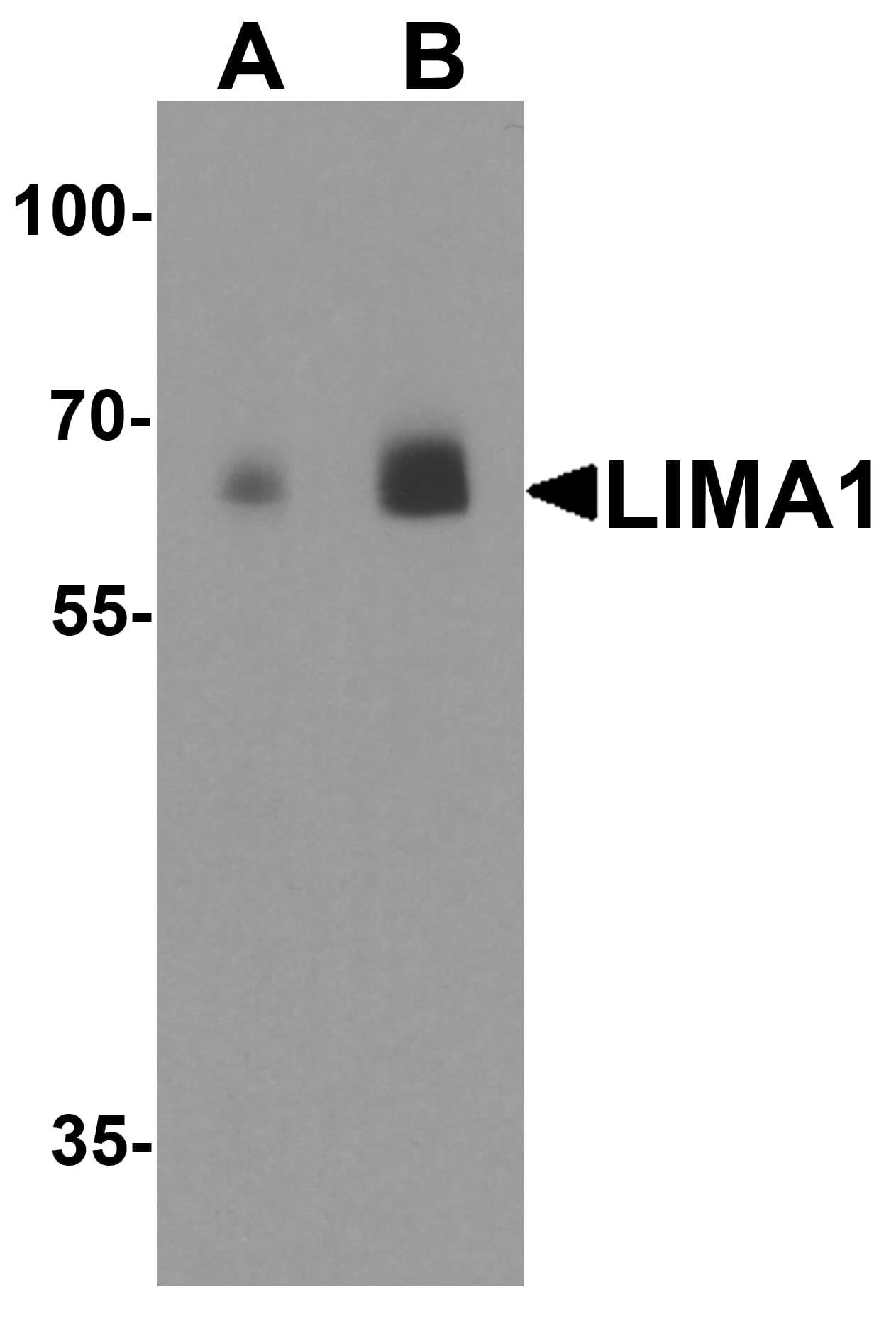 EPLIN Antibody