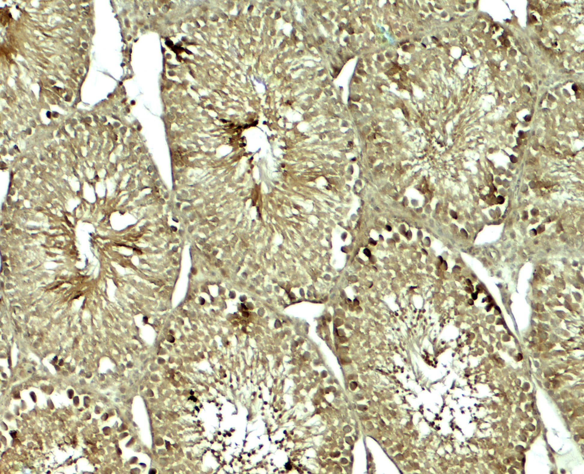 SOX4 Antibody