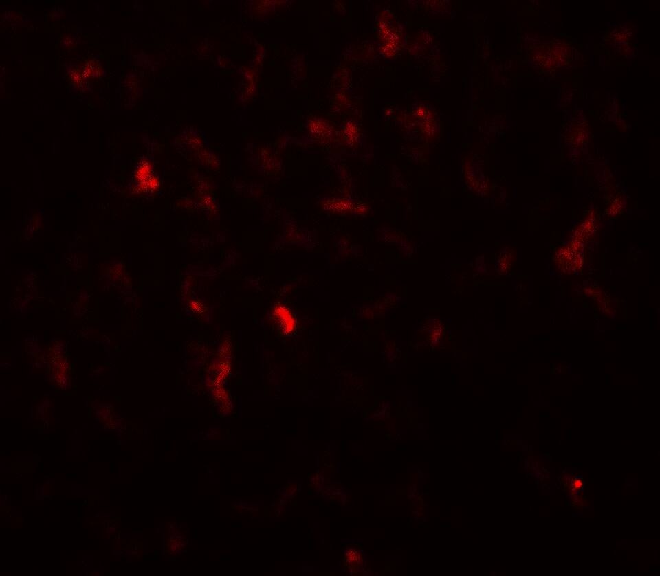 Hexokinase 1 Antibody