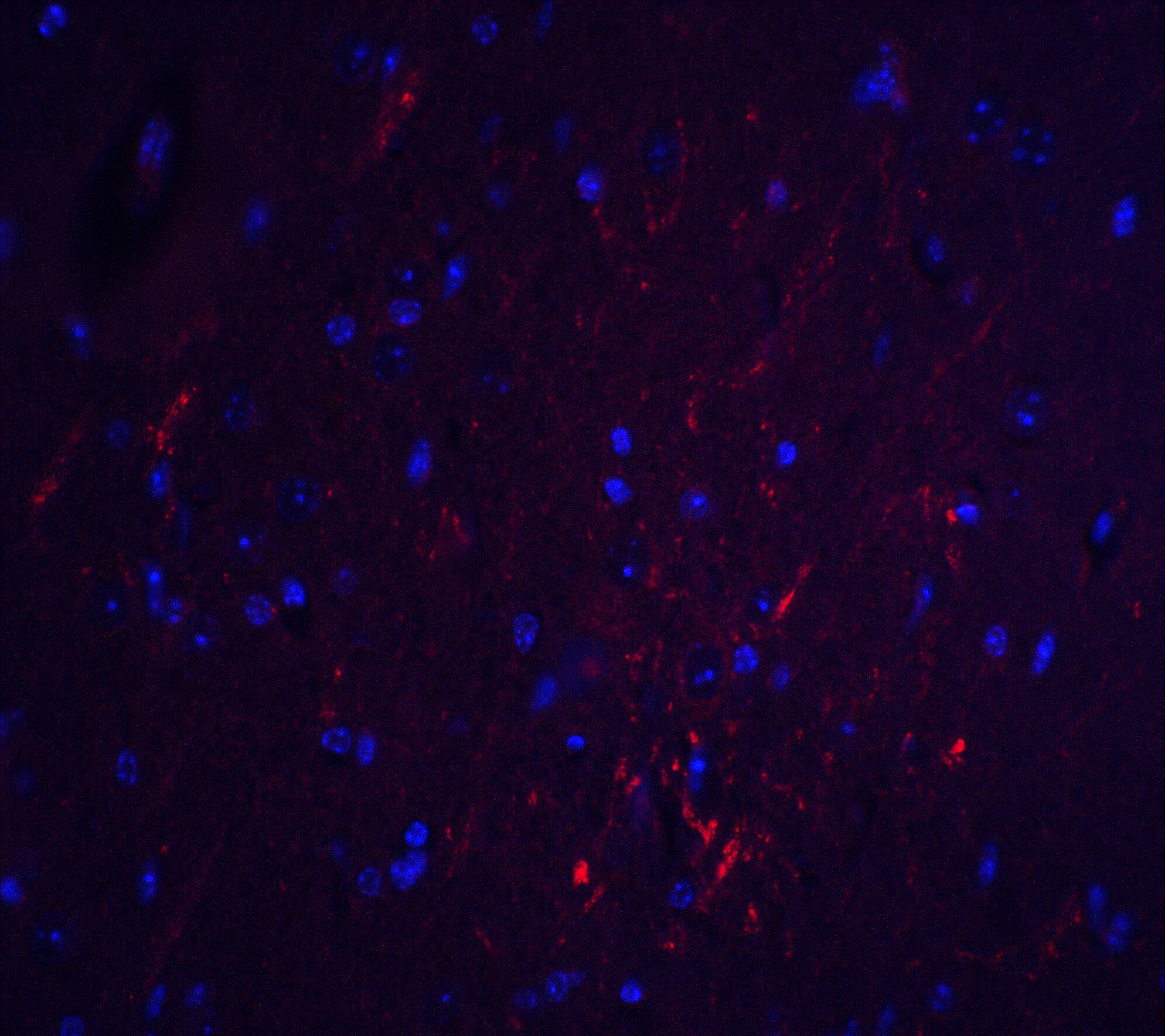 S1P2/EDG-5/S1PR2 Antibody