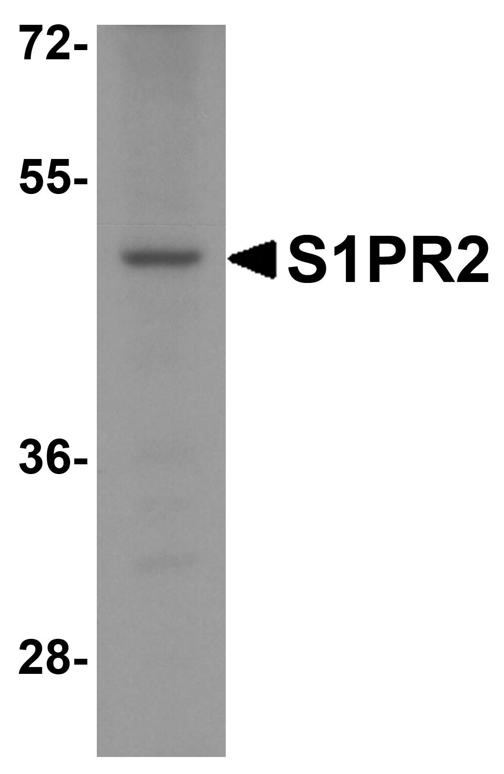 S1P2/EDG-5/S1PR2 Antibody