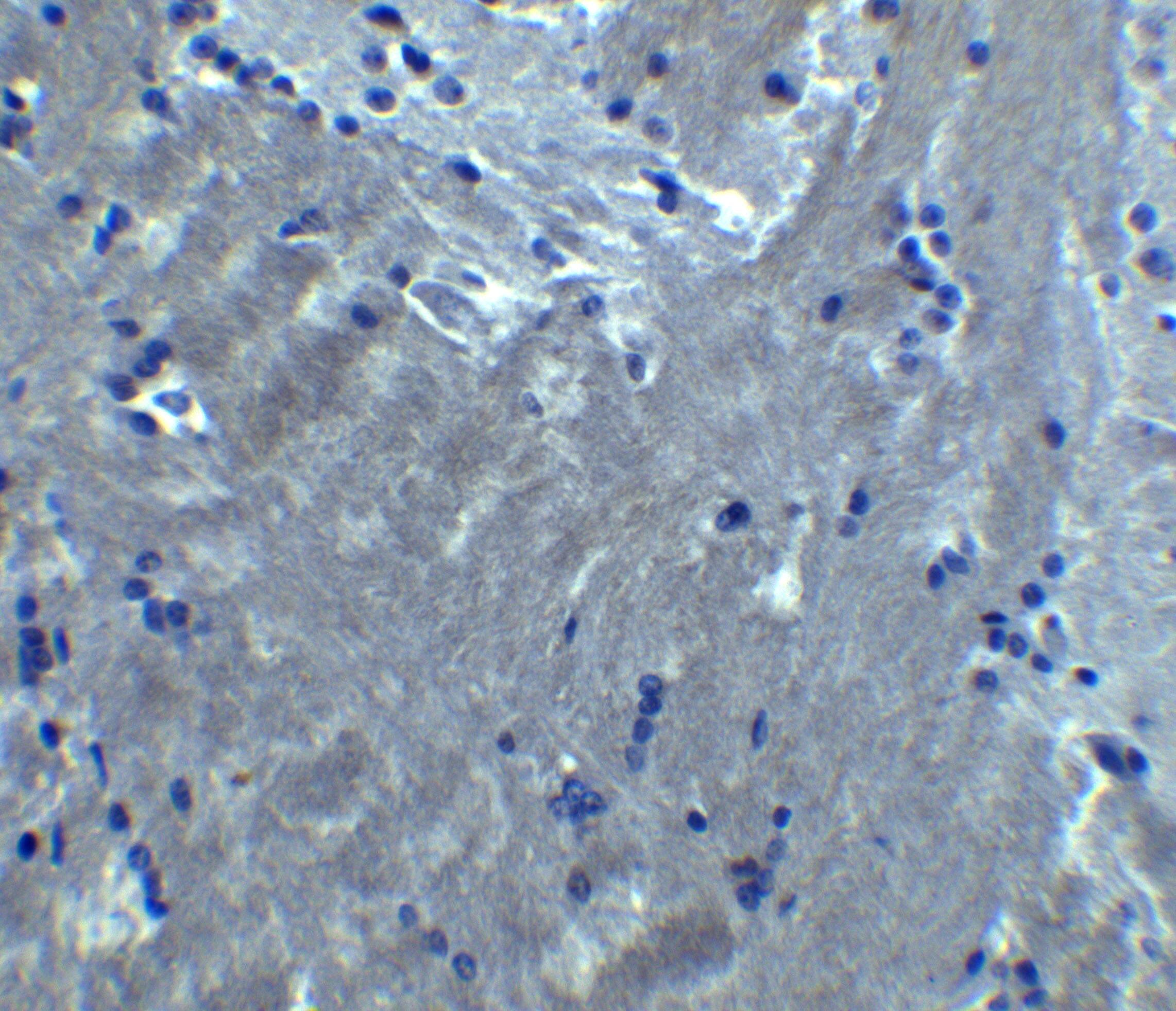 S1P2/EDG-5/S1PR2 Antibody