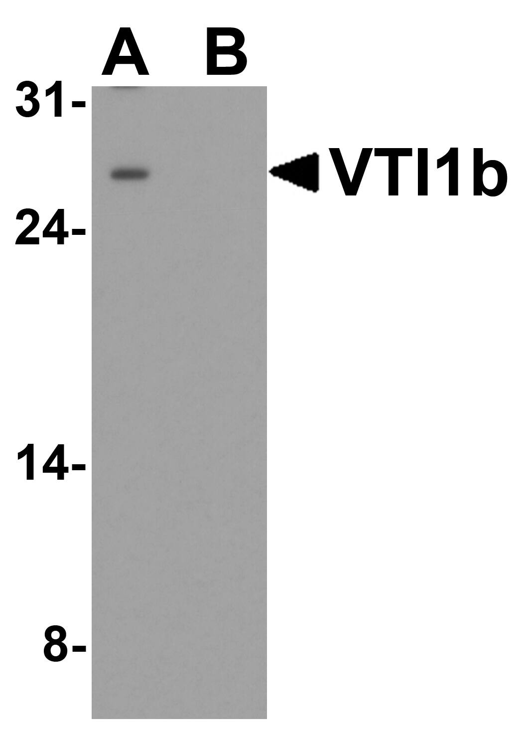 VTI1B Antibody