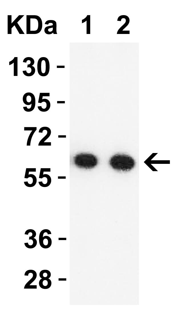 SARS-CoV-2 pp1ab polyprotein Antibody