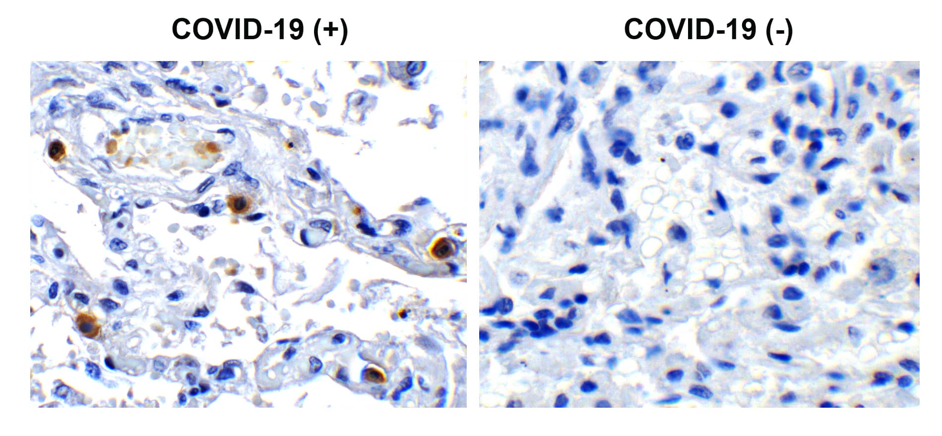 SARS-CoV-2 pp1ab polyprotein Antibody