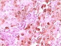 CACYBP Antibody (7D11A8)