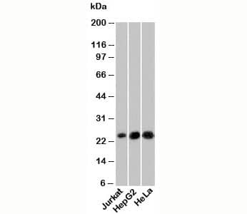 NKIRAS1 Antibody (NRAS285)