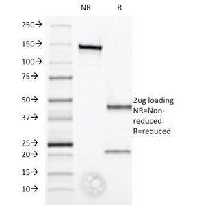 IFN-alpha 1 Antibody (2.52)