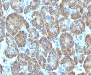 TOP1MT Antibody (TPIMT-1)