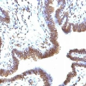 EMI1 Antibody (FBXP5)