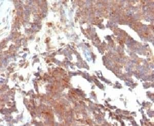 GnRHR Antibody (LCHR37)