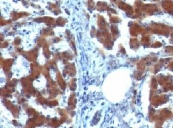 Retinol Binding Protein RBP Antibody (RLBD1)