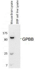 Glycogen Phosphorylase BB/GPBB Antibody (E9B10)