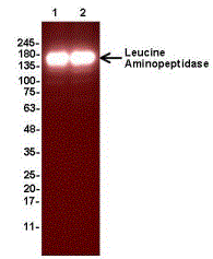 Leucyl-cystinyl Aminopeptidase/LNPEP Antibody (E2)