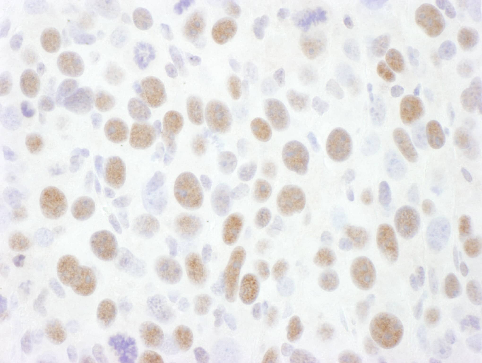 Cdk9 Antibody