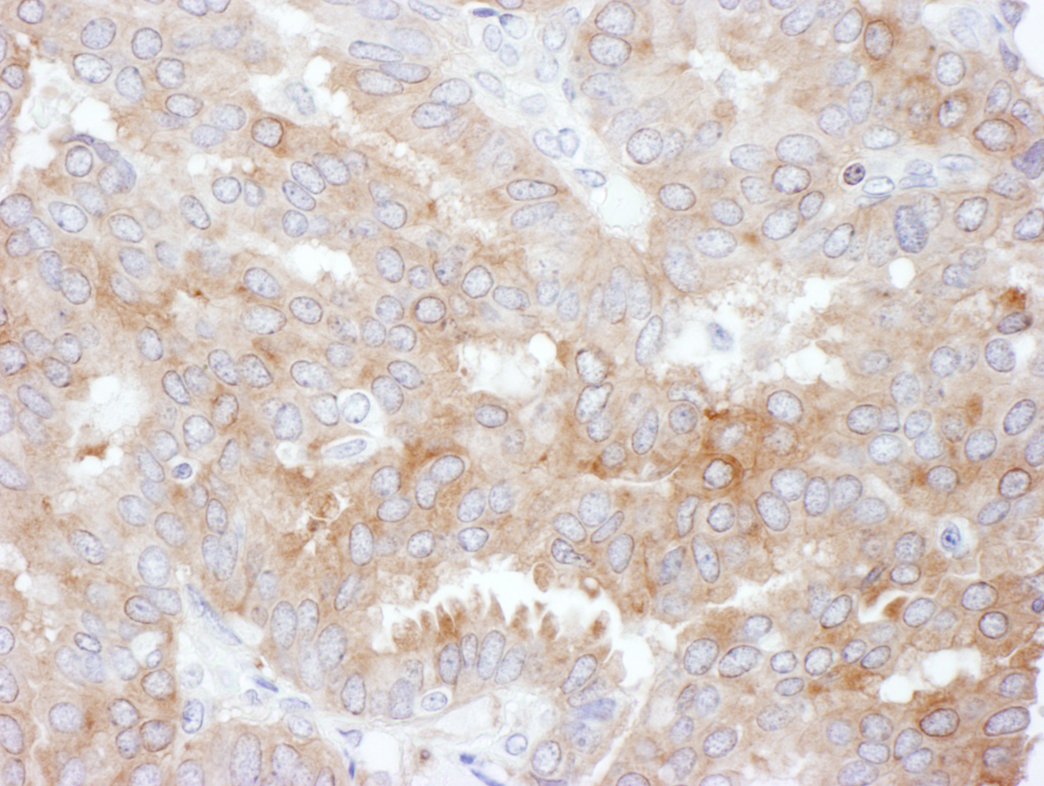 NHERF-1 Antibody