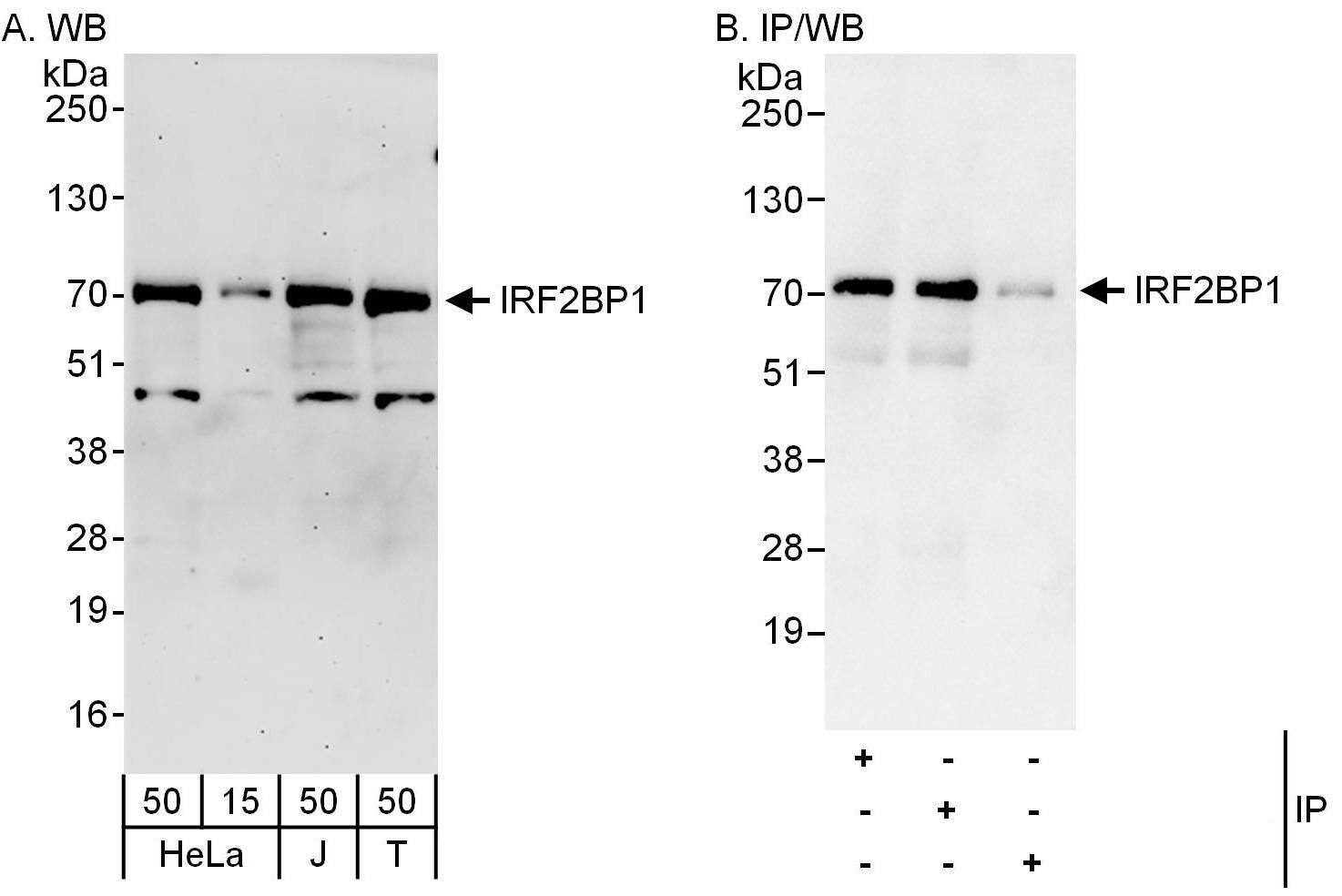 IRF2BP1 Antibody