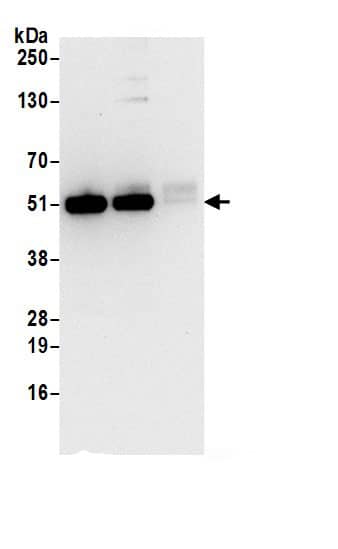 HADHB Antibody