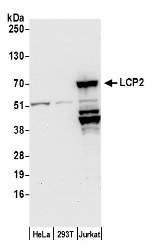 SLP-76/LCP2 Antibody
