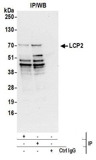 SLP-76/LCP2 Antibody