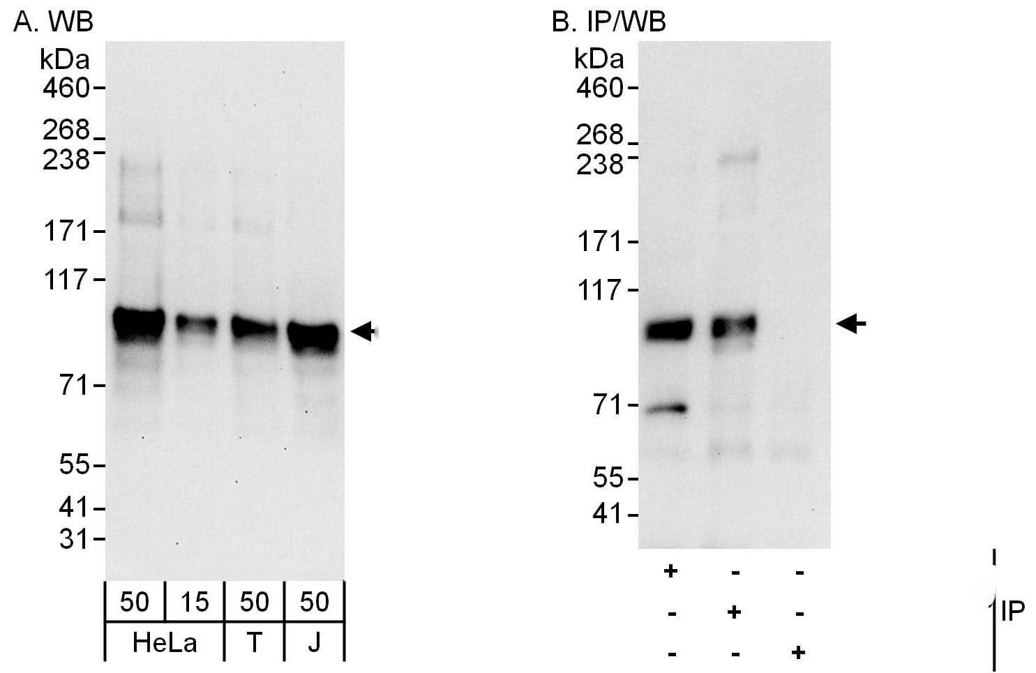 DYRK1A Antibody