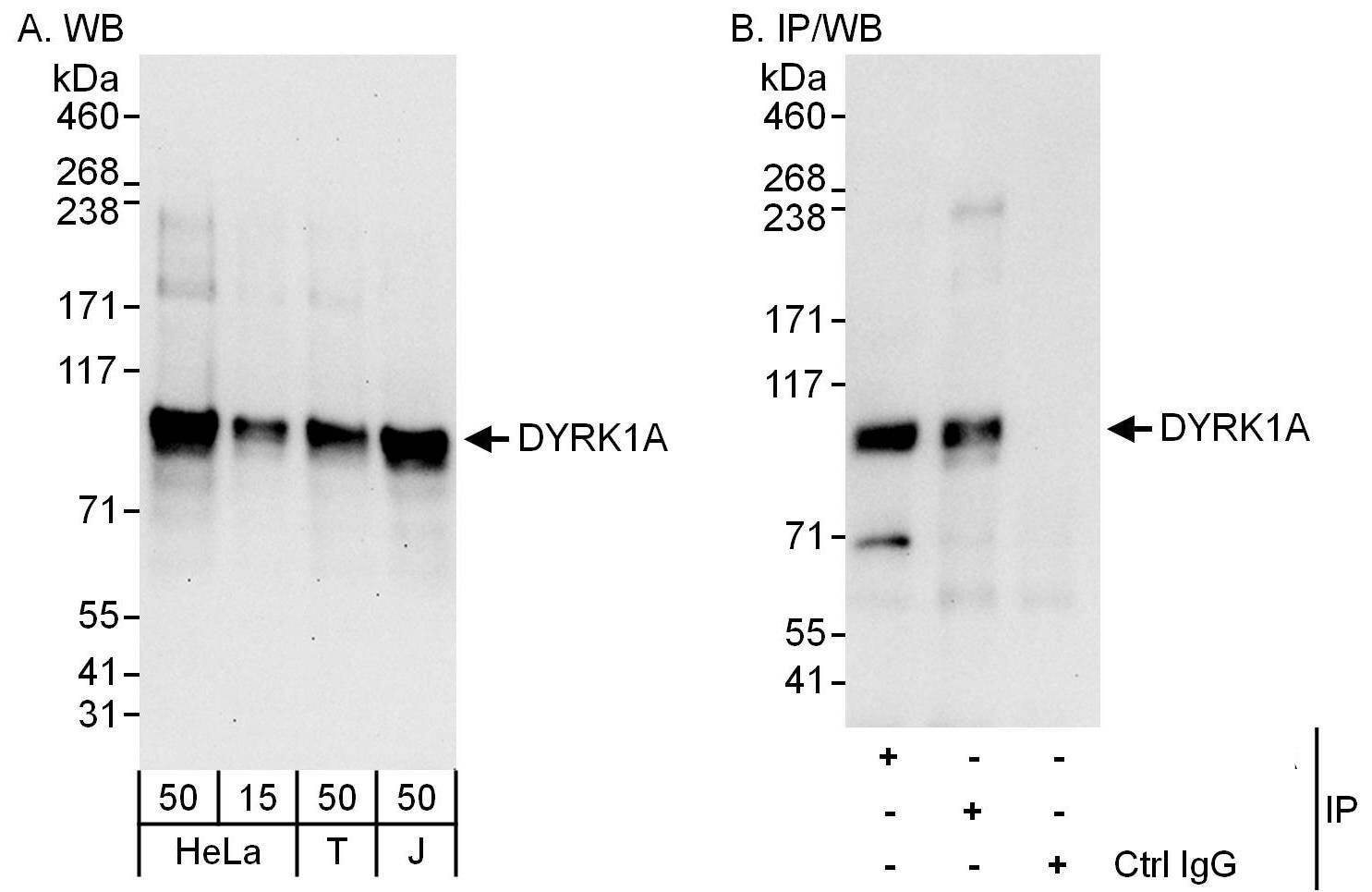 DYRK1A Antibody