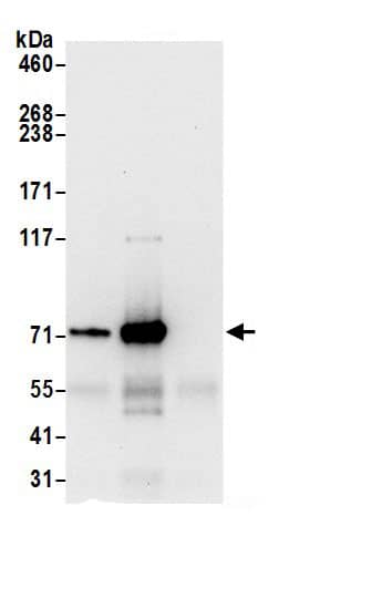 HADHA Antibody