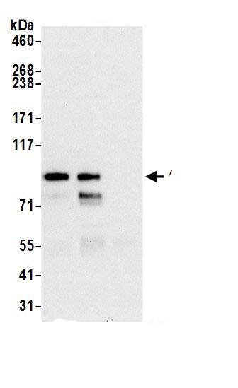 AMPD3 Antibody