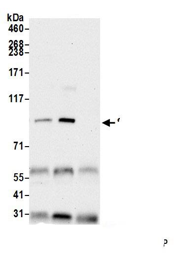 SARDH Antibody