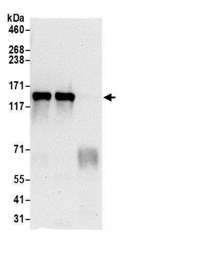 DNA helicase B Antibody