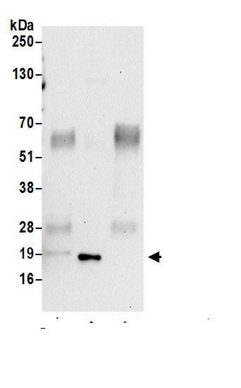 KIAA1143 Antibody