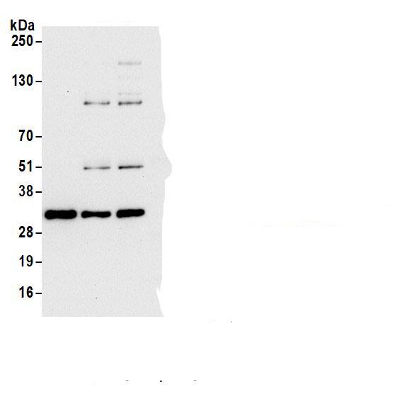 CBR1 Antibody