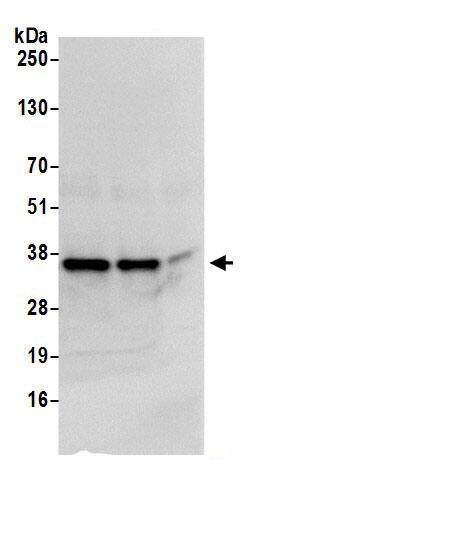 CBR1 Antibody