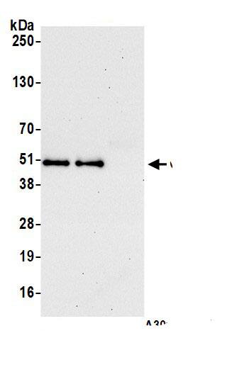 Calumenin Antibody