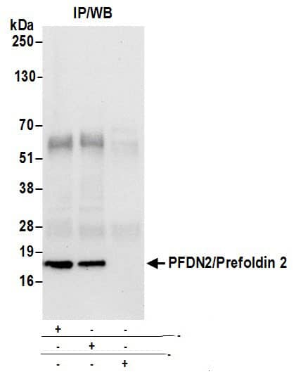 PFDN2 Antibody