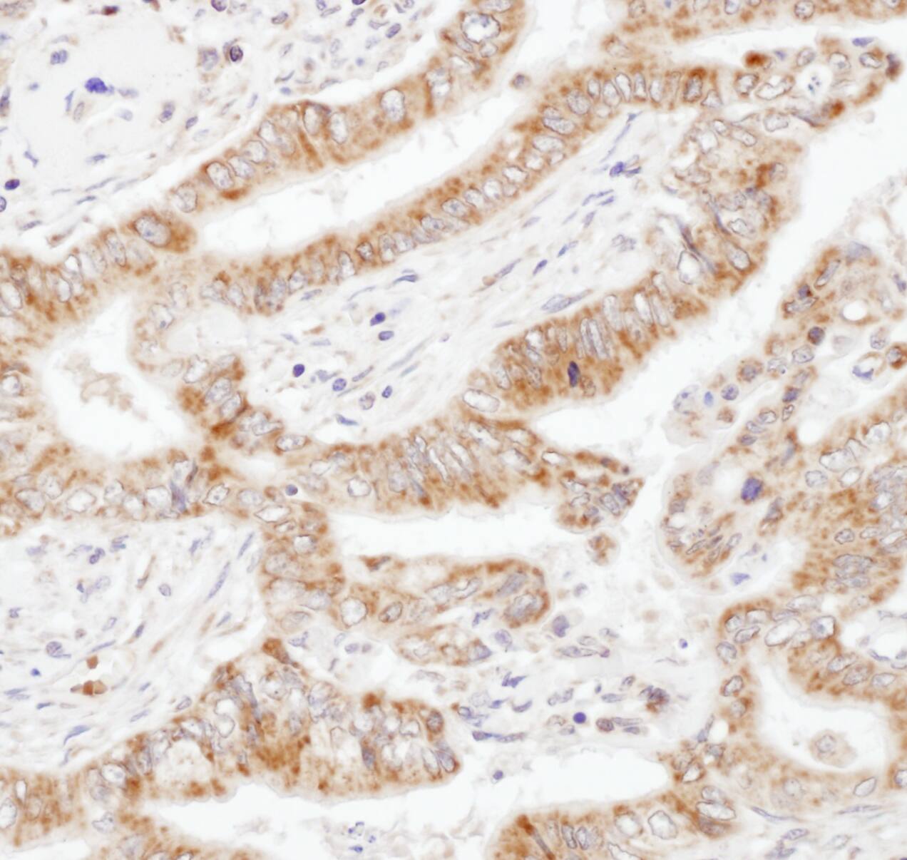 UBAC1 Antibody