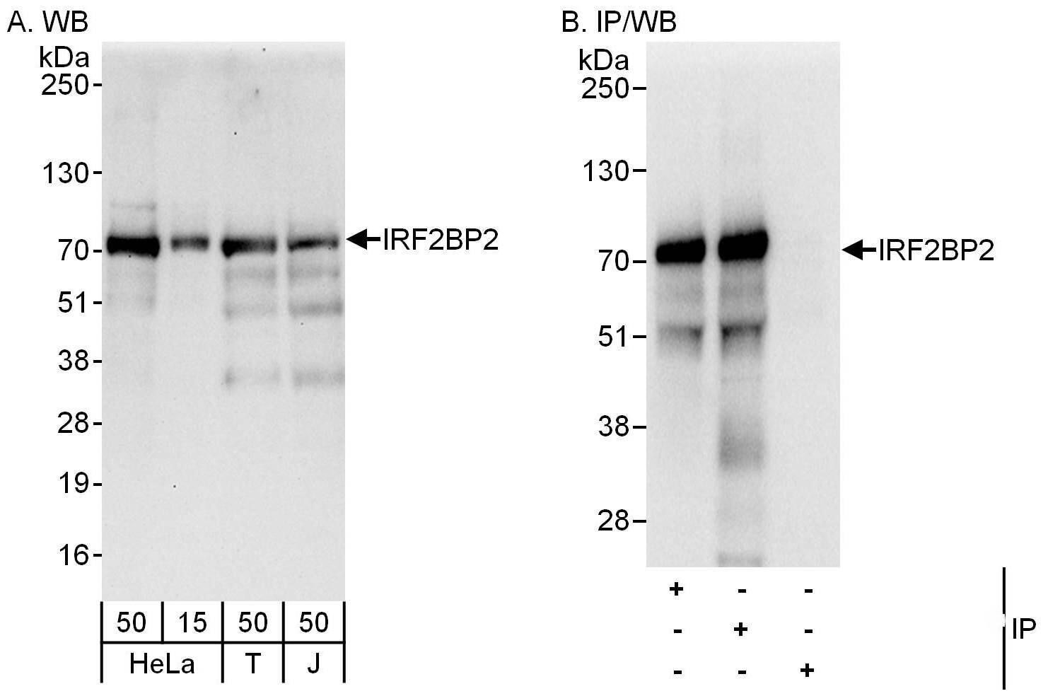 IRF2BP2 Antibody