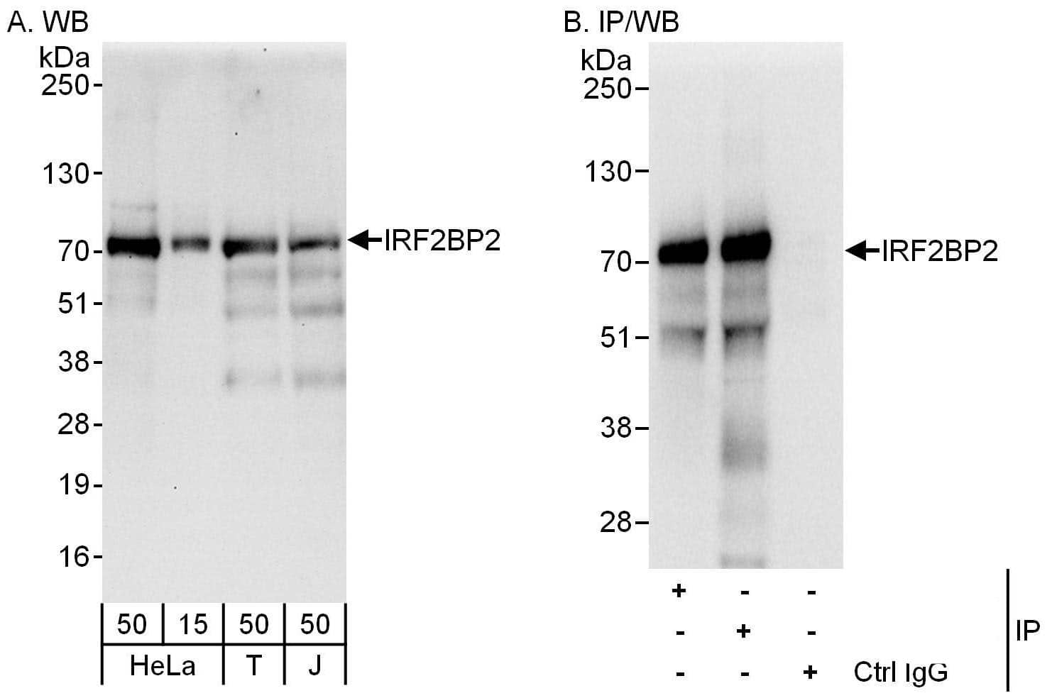 IRF2BP2 Antibody