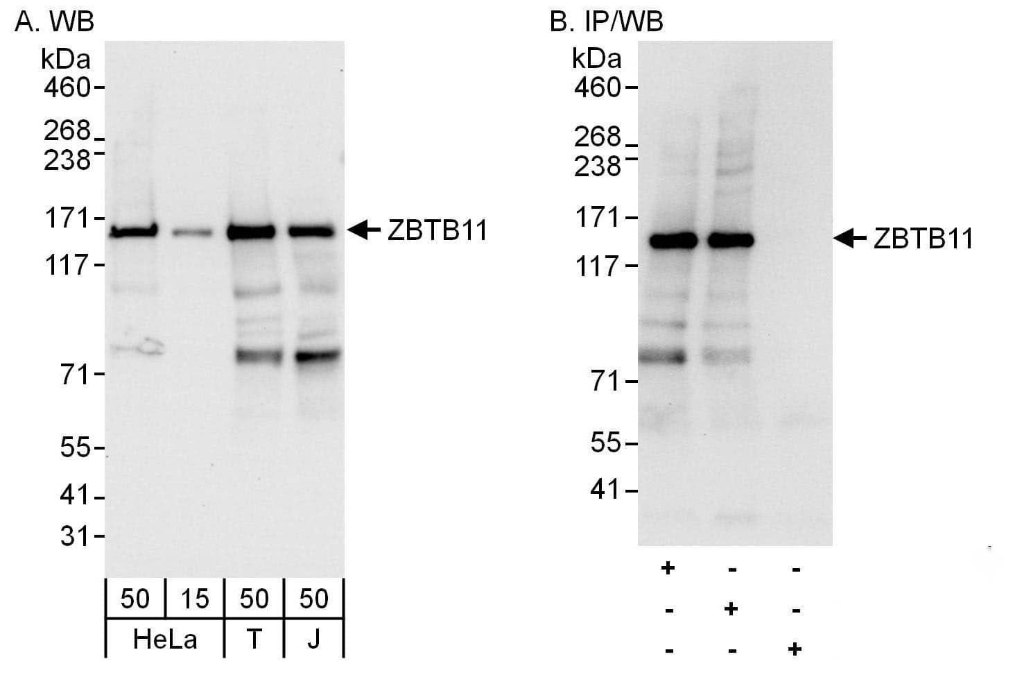 ZBTB11 Antibody