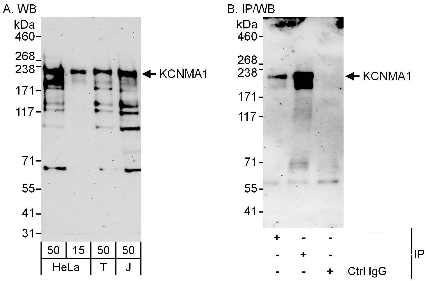 Maxi Potassium channel alpha Antibody