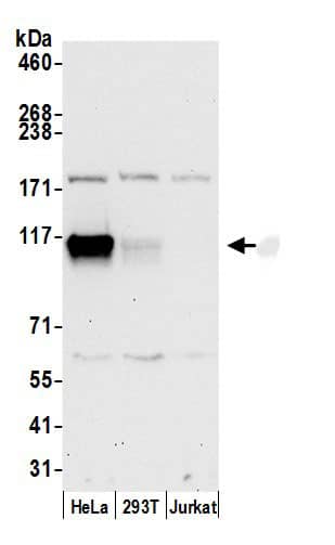 Aspartate beta hydroxylase Antibody