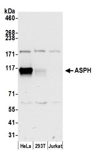 Aspartate beta hydroxylase Antibody