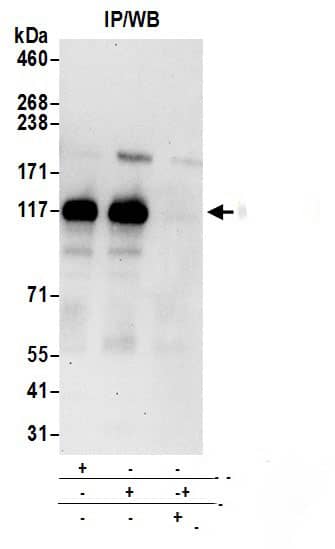 DCBLD2/ESDN Antibody