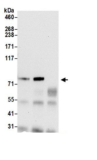 QARS Antibody