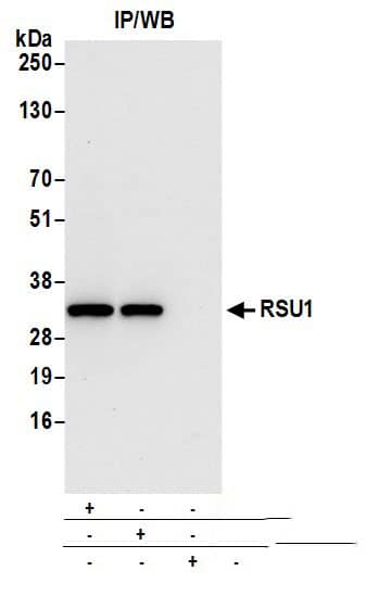 RSU1 Antibody