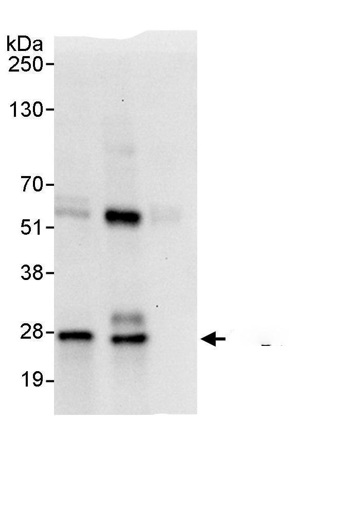 CCDC28A Antibody