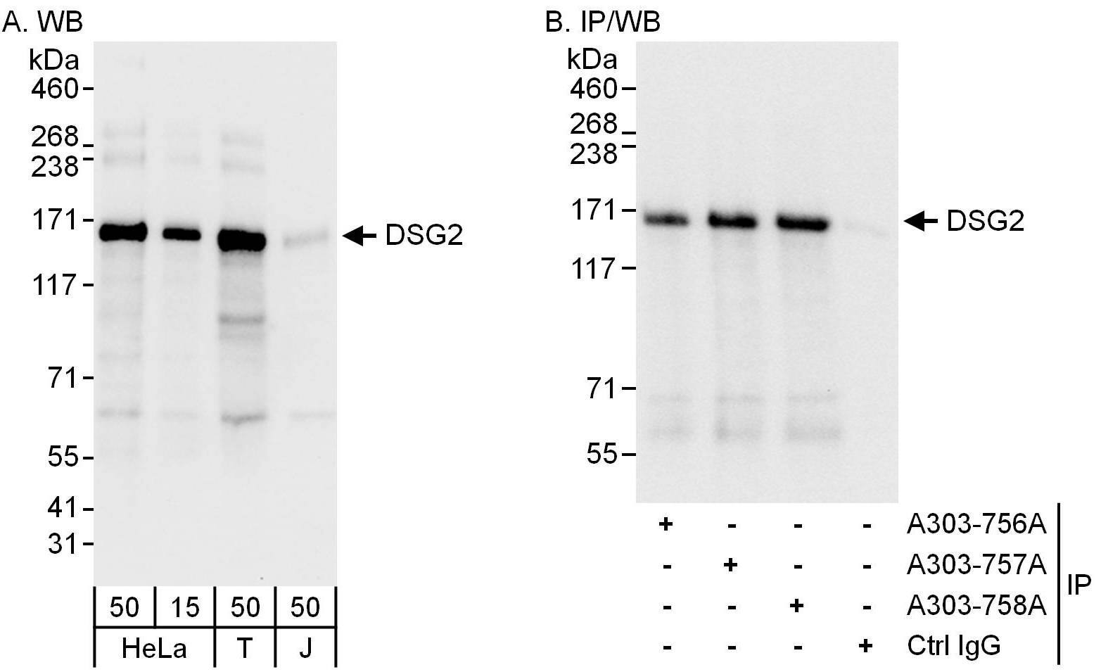 Desmoglein-2 Antibody