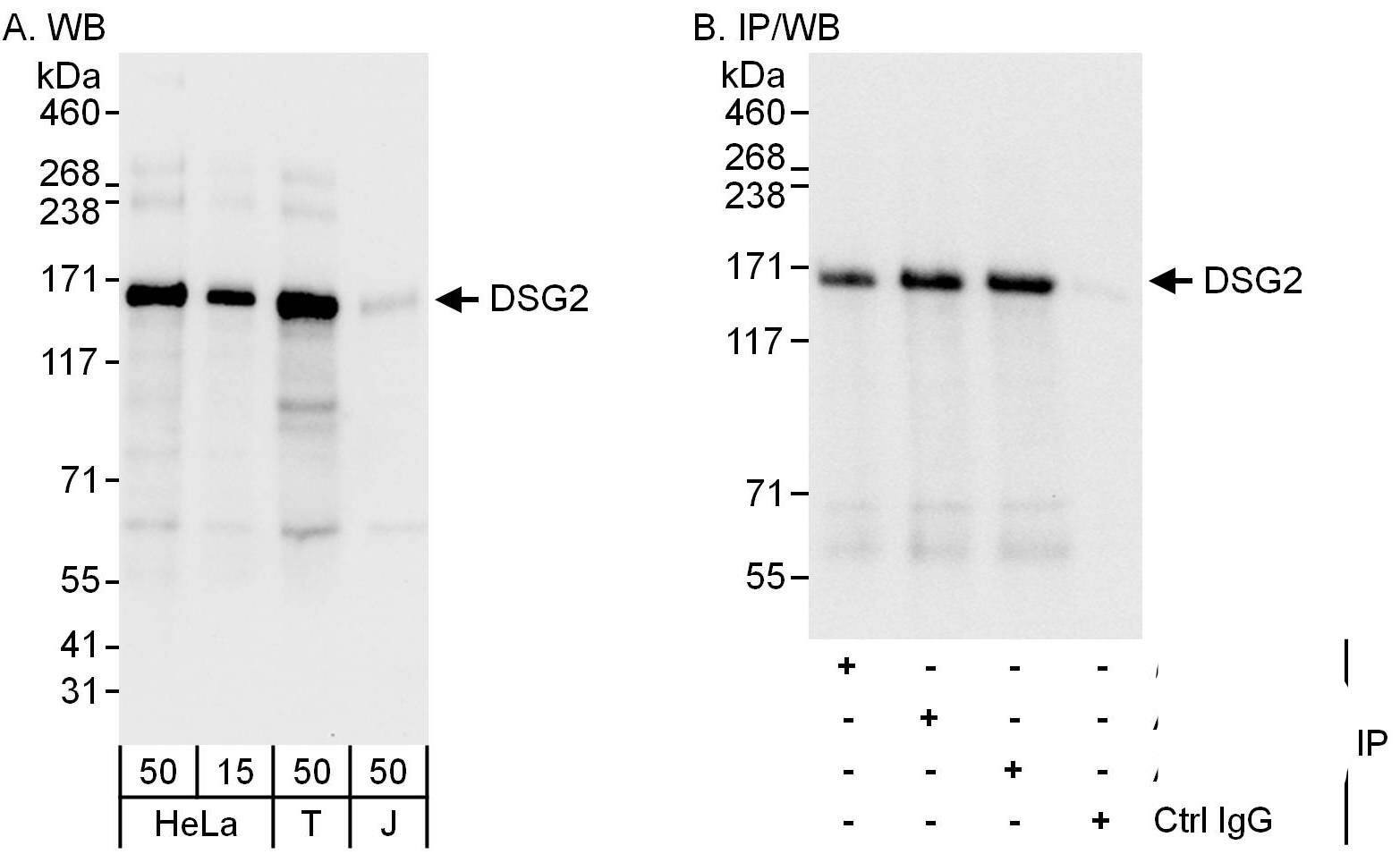 Desmoglein-2 Antibody