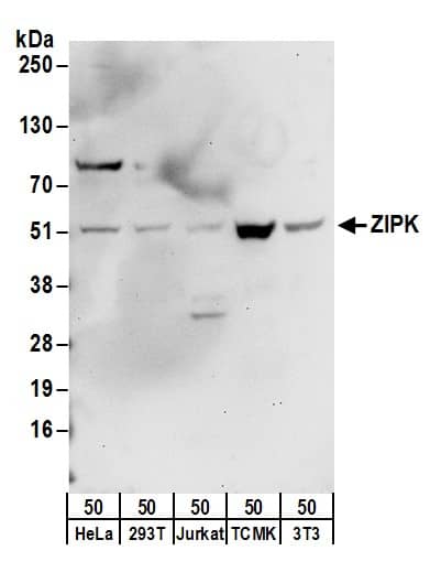 DAPK3/ZIPK Antibody