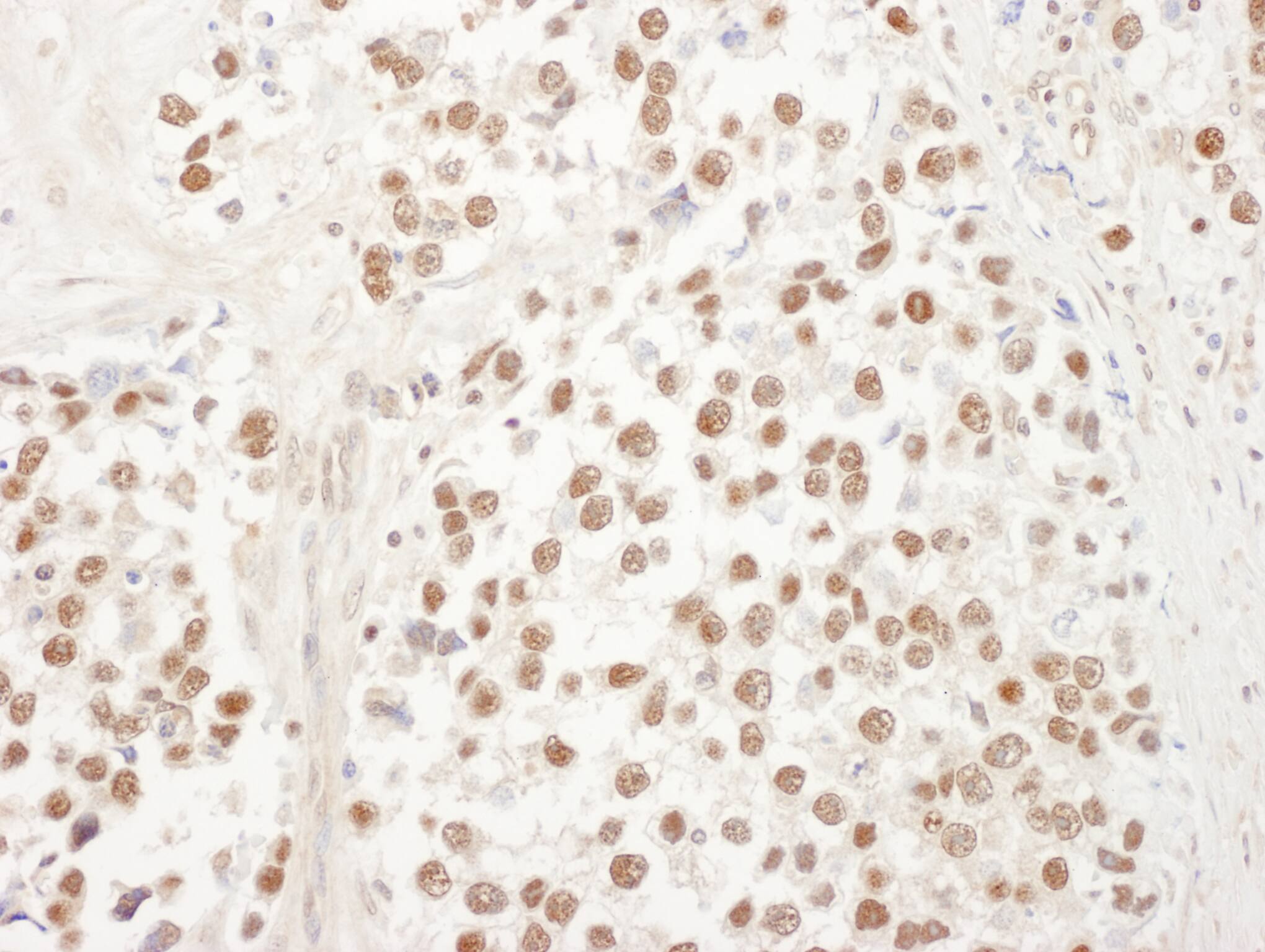 UBL7 Antibody